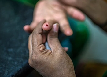 WHO Global Diabetes Compact
